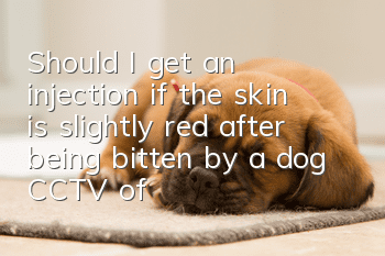 Should I get an injection if the skin is slightly red after being bitten by a dog? CCTV official teaches you how to judge!