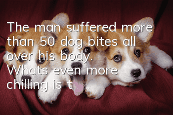 The man suffered more than 50 dog bites all over his body. What’s even more chilling is that the dog owner behaved like this